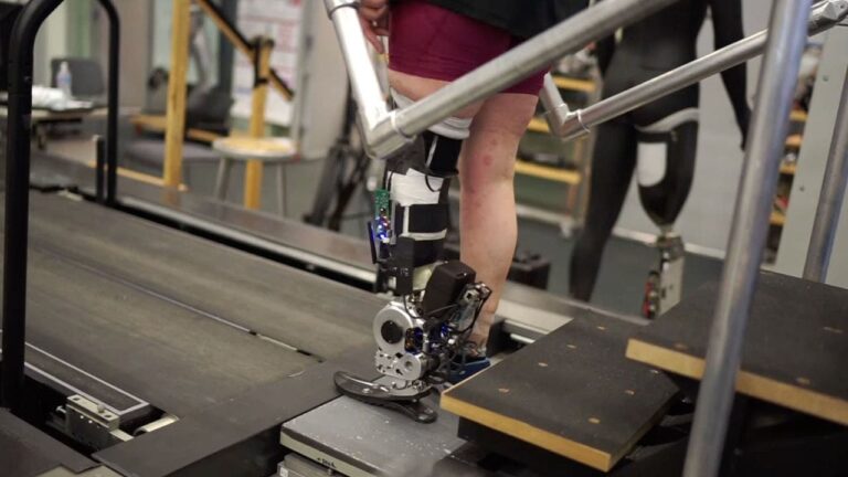 5 Breakthrough prosthetic technology enables natural movement through nervous system connection